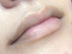 薄い唇の画像